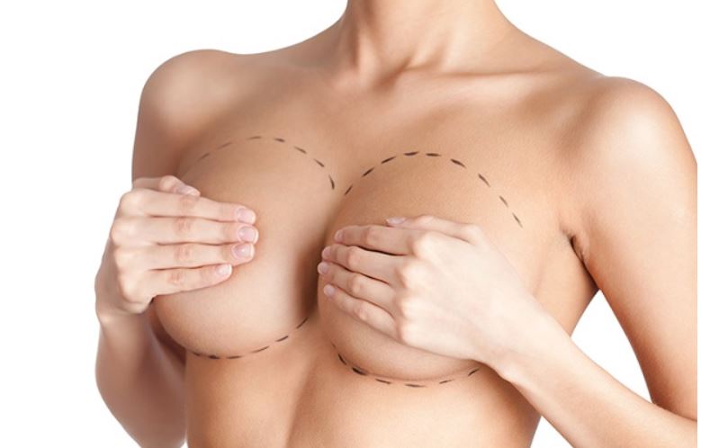 Phẫu thuật nâng ngực có đau không?