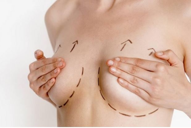 Phẫu thuật nâng ngực chảy xệ có đau không?