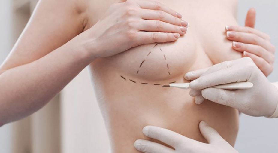 Phẫu thuật nâng ngực có nguy hiểm không?