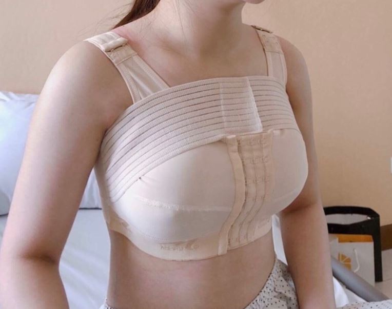 Sử dụng áo ngực định hình sau phẫu thuật