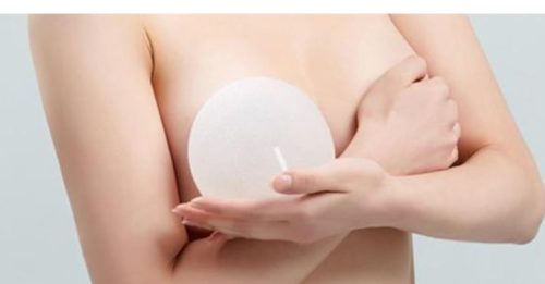 Phương pháp nâng ngực nội soi túi độn